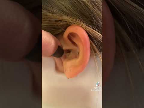 WaxRx® Deluxe Ear Wash System used by kellyknox33 on TikTok